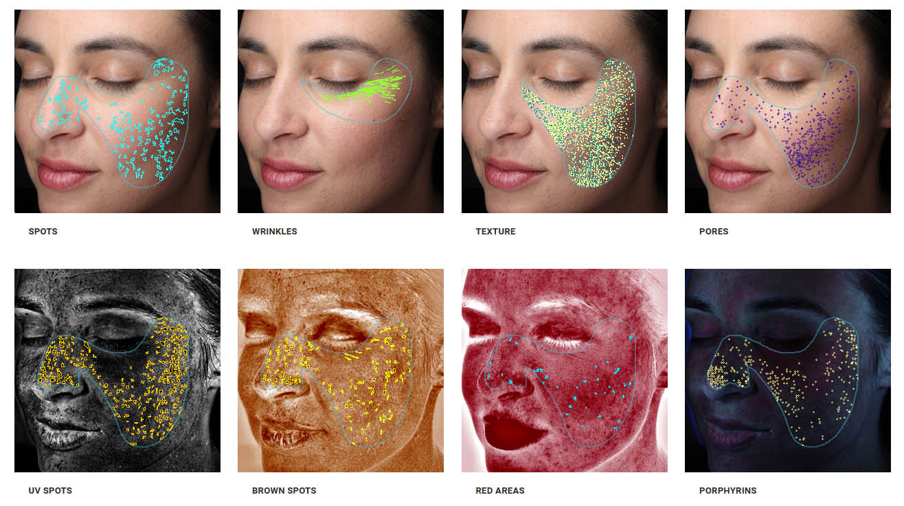 LAZ Skincare Skin Imaging Example